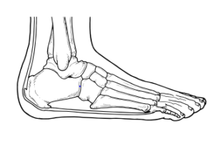 Illustration showing the bones and the band of the foot. The ban represents the plantar fascial band and Achilles tendon.